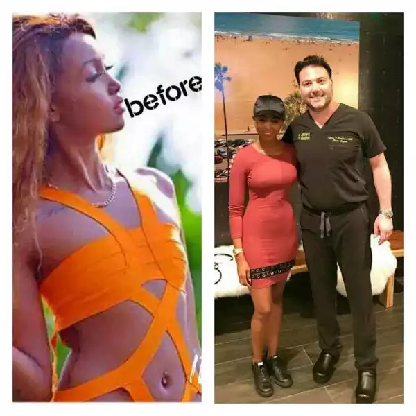 Ex-Big Brother Africa Star, Monroe Suffers Complications After B.reast Enlargement Surgery (Photos)